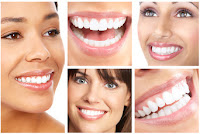 Boca, saliva, dentes implantes de dentes