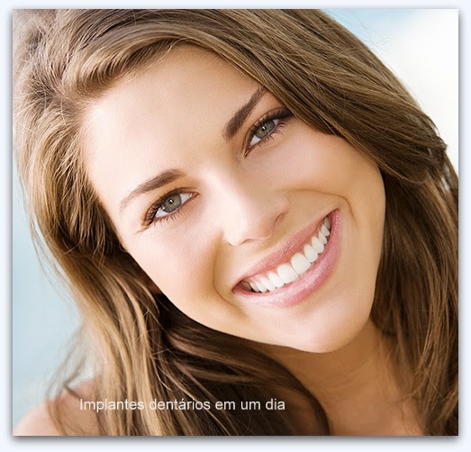 Implantes dentários em um dia tratamentos dentários em um dia