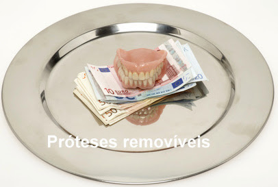 próteses removiveis implantes dentários