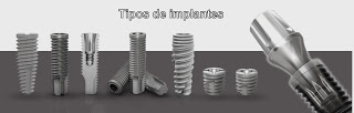 Implantes dentarios implante titanium