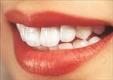 Sorriso perfeito